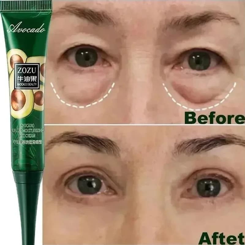 Creme Instantâneo Antirrugas Para Os Olhos